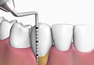 periodoncia periodoncia
